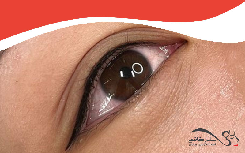 عوامل موثر بر ماندگاری بن مژه